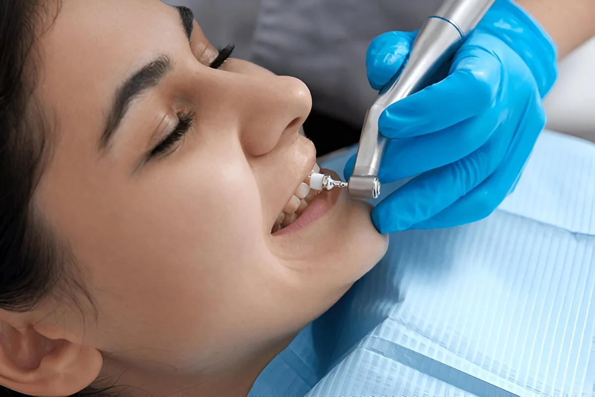 dental cleaning near you
