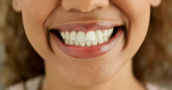 zoom whitening in downtown toronto